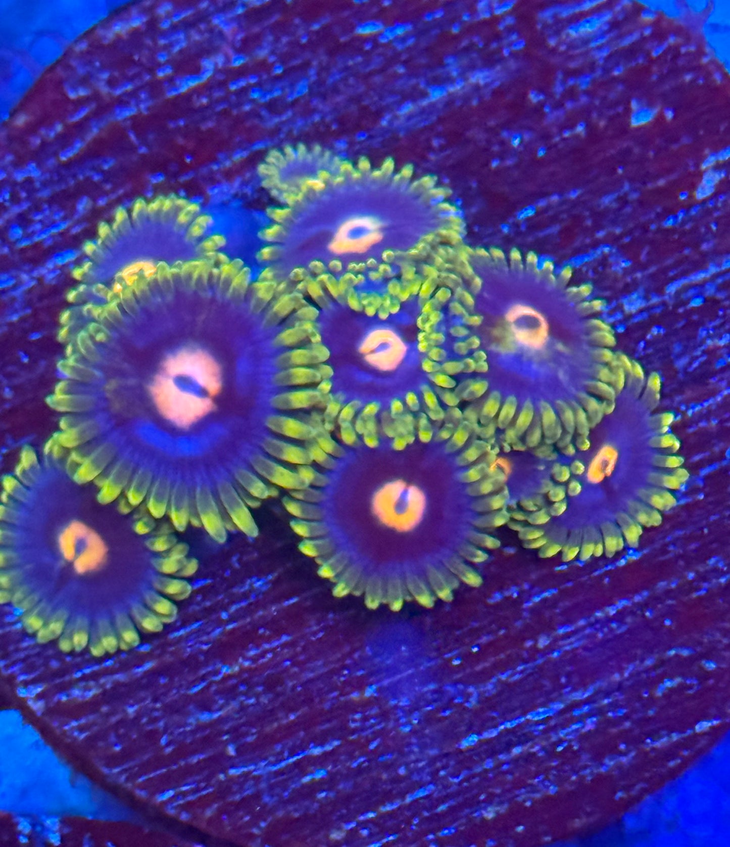 Zoas